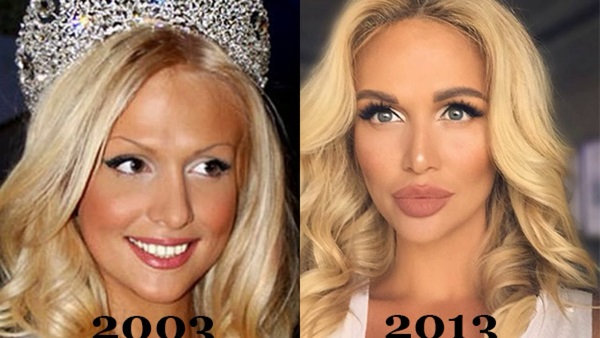 Фотографије пре и после пластике звезда руског, страног, холивудског, шоу бизниса, сцене. Успешне и неуспешне операције
