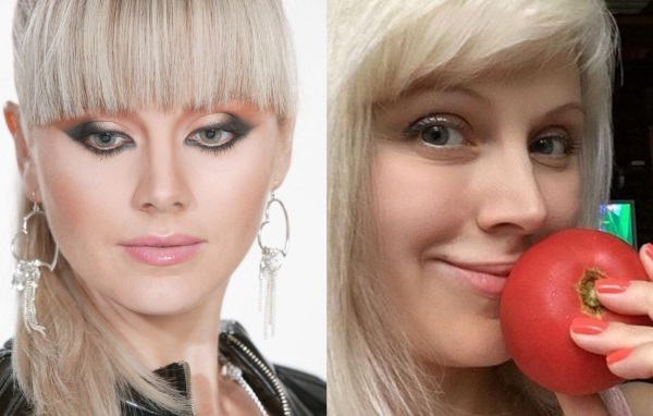 Фотографије пре и после пластике звезда руског, страног, холивудског, шоу бизниса, сцене. Успешне и неуспешне операције