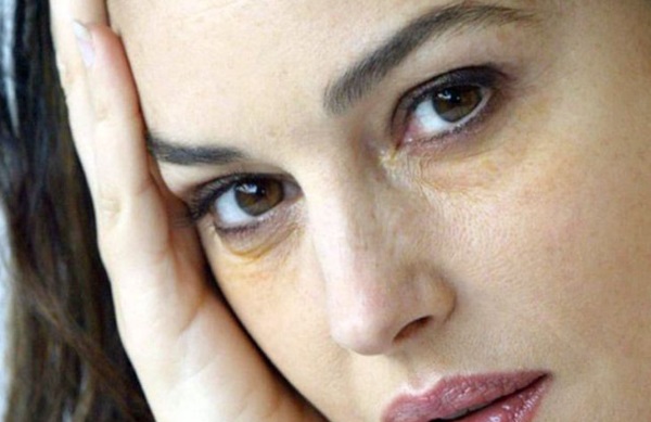 كيف تتخلصين بسرعة من كدمات تحت العينين بالمنزل