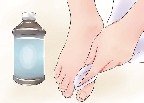 Cách khử mùi hôi chân hiệu quả. Các biện pháp khắc phục tốt nhất ở hiệu thuốc, nguyên nhân và cách điều trị chứng ra mồ hôi