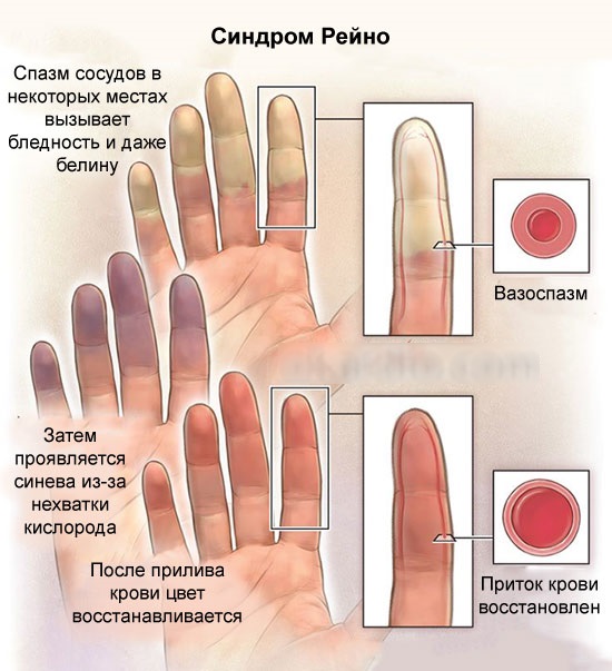 Carboxytherapy - สำหรับใบหน้าในด้านความงามคืออะไร: ไม่ฉีด, ไม่รุกราน, ฉีด ก่อนและหลังภาพถ่ายราคาบทวิจารณ์