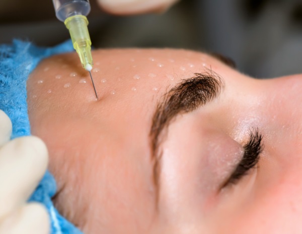 Carboxytherapy - สำหรับใบหน้าในด้านความงามคืออะไร: ไม่ฉีดไม่รุกรานการฉีด ก่อนและหลังภาพถ่ายราคาบทวิจารณ์