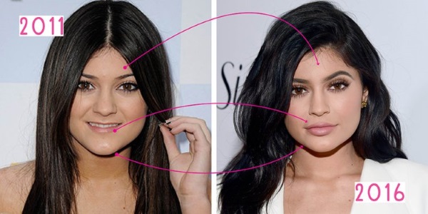 Kylie Jenner trước và sau khi phẫu thuật thẩm mỹ: ảnh không trang điểm, photoshop, mặc áo tắm, khi mang bầu. Bao nhiêu tuổi, chiều cao, các thông số, tiểu sử