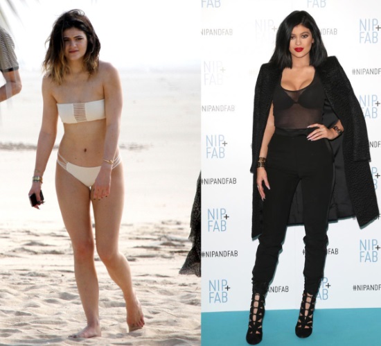 Kylie Jenner trước và sau khi phẫu thuật thẩm mỹ: ảnh không trang điểm, photoshop, mặc áo tắm, khi mang bầu. Bao nhiêu tuổi, chiều cao, các thông số, tiểu sử