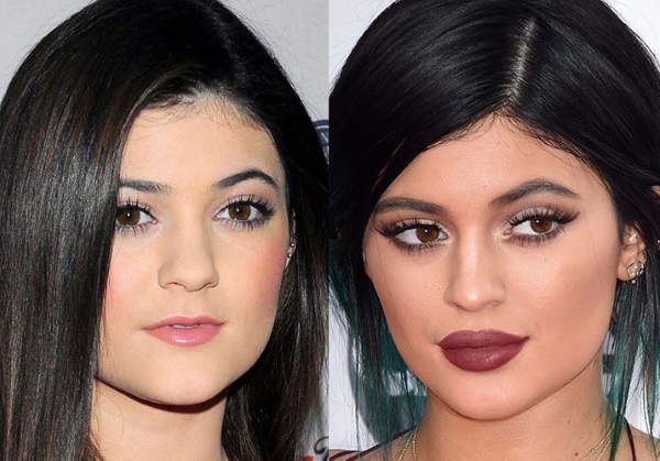 Kylie Jenner trước và sau khi phẫu thuật thẩm mỹ: ảnh không trang điểm, photoshop, mặc áo tắm, khi mang bầu. Bao nhiêu tuổi, chiều cao, các thông số, tiểu sử