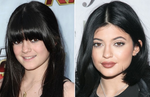 Kylie Jenner trước và sau khi phẫu thuật thẩm mỹ: ảnh không trang điểm, photoshop, mặc áo tắm, khi mang bầu. Bao nhiêu tuổi, chiều cao, các thông số, tiểu sử