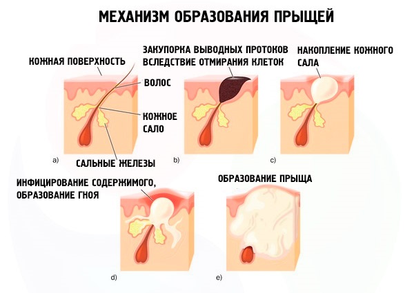 Зорка крема. Упутство за употребу људима са испуцаним петама, варикозним венама, псоријазом, петним остругама, дерматитисом, екцемом, хемороидима