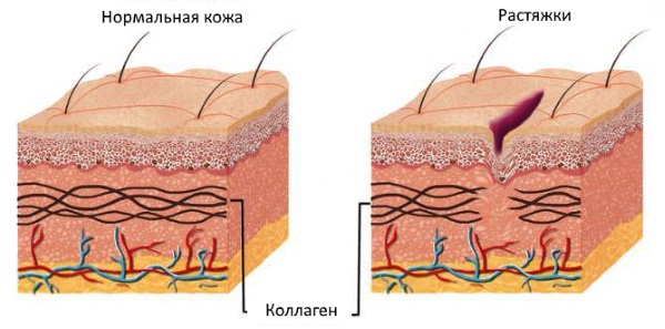 Зорка крема. Упутство за употребу људима са испуцаним петама, варикозним венама, псоријазом, петним остругама, дерматитисом, екцемом, хемороидима