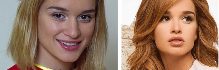 Ksenia Borodina. Hình ảnh trước và sau khi phẫu thuật thẩm mỹ và giảm cân. Ngôi sao đã thực hiện những hoạt động gì, tiểu sử và cuộc sống cá nhân
