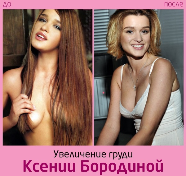 Ksenia Borodina. Hình ảnh trước và sau khi phẫu thuật thẩm mỹ và giảm cân. Ngôi sao đã thực hiện những hoạt động gì, tiểu sử và cuộc sống cá nhân