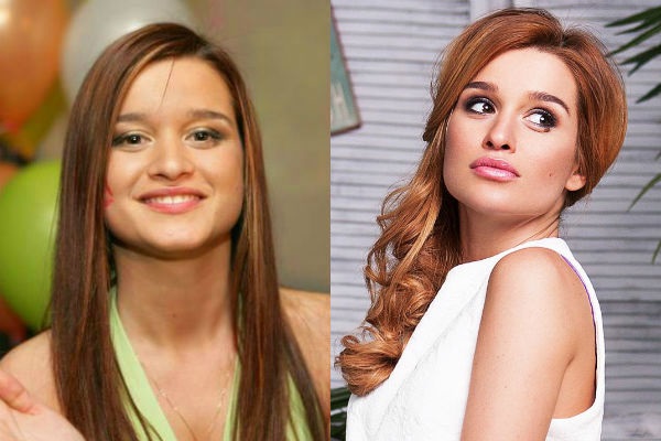 Ksenia Borodina. Hình ảnh trước và sau khi phẫu thuật thẩm mỹ và giảm cân. Ngôi sao đã thực hiện những hoạt động gì, tiểu sử và cuộc sống cá nhân