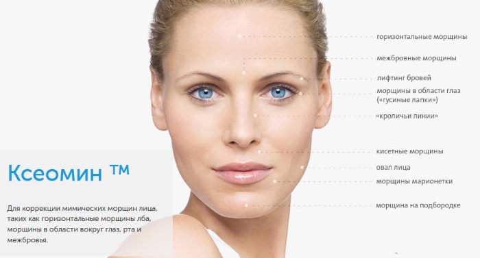 Xeomin. Hướng dẫn sử dụng trong thẩm mỹ, thần kinh. Giá cả, chất tương tự