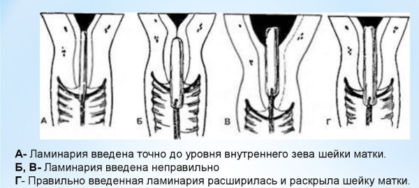 Келп. Корисна својства, састав, упутства за употребу алги. Рецепти за маске за лице, мршављење, облози, стимулација рада