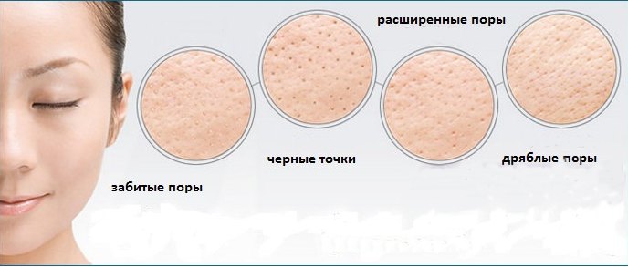Лед за лице од бора. Предности и штете, рецепти са млеком, камилицом, алојом, першуном, кафом, уљима, лимуном