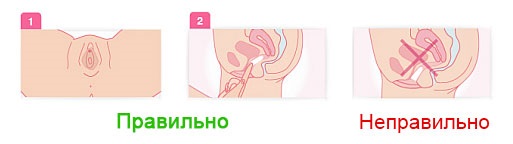 Уље целандина. Особине и примена код кожних и гљивичних болести, у козметологији, гинекологији