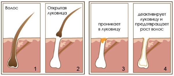 Уље целандина. Особине и примена код кожних и гљивичних болести, у козметологији, гинекологији