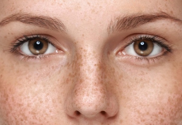 Microneedling: nó là gì, nó được thực hiện như thế nào. Thiết bị, chống chỉ định, giá của quy trình, đánh giá