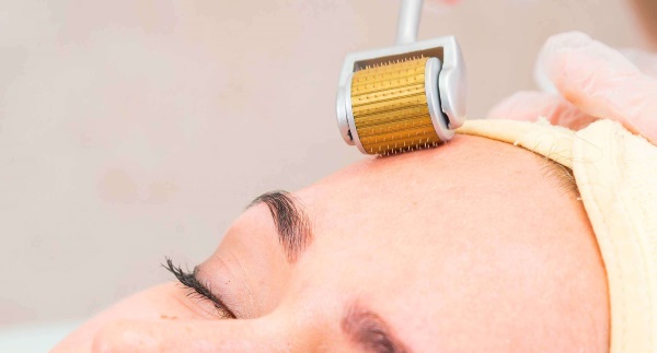 Microneedling: nó là gì, nó được thực hiện như thế nào. Thiết bị, chống chỉ định, giá của quy trình, đánh giá