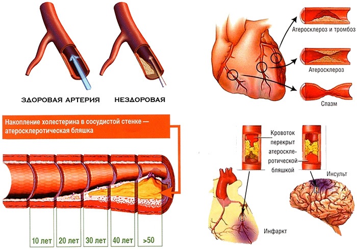 Otot belakang: senaman untuk menguatkan di rumah, di gim, dengan osteochondrosis, scoliosis