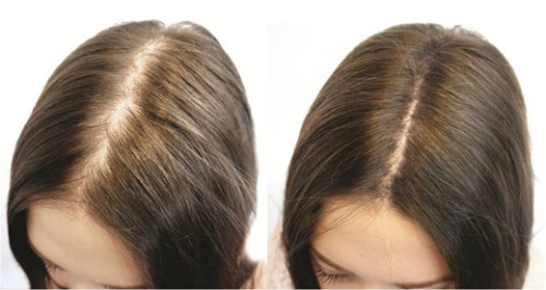 Niacinamida para pele facial, cabelo, contra manchas senis. Propriedades, conforme aplicável, instrução