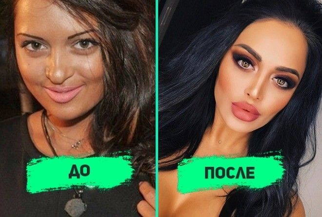 Нита Кузмина пре и после пластике. Фотографија, какве је операције звезда радила, биографија