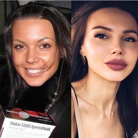 Oksana Samoilova vor und nach der plastischen Chirurgie: Foto in seiner Jugend vor der Operation, Größe, Gewicht, Tätowierung, Figurenparameter