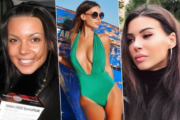Oksana Samoilova vor und nach der plastischen Chirurgie: Foto in seiner Jugend vor der Operation, Größe, Gewicht, Tätowierung, Figurenparameter