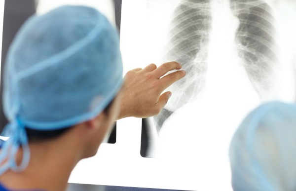 Operação de mamoplastia: redução, aumento, endoscopia laser, sem implantes, masculinização. Estágios, reabilitação e complicações