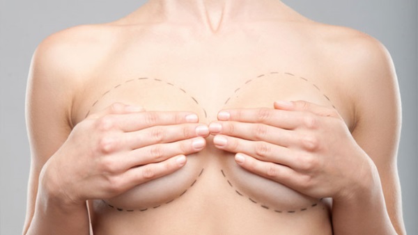 Operação de mamoplastia: redução, aumento, endoscopia laser, sem implantes, masculinização. Estágios, reabilitação e complicações