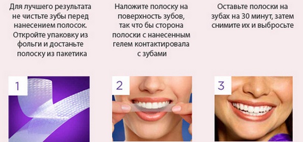 Траке за избељивање зуба: 3д бела, Бленд а Мед, Црест, Ригел, напредни зуби, Орал Про, јарко светло. Цене у апотекама