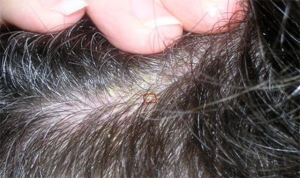 Bột tóc cho khối lượng. Đánh giá Estelle, Taft, Osis, got2b, Kapus, Matrix. Cách sử dụng