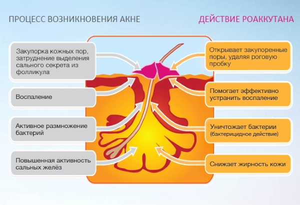 Roaccutane. Hướng dẫn sử dụng, tác dụng phụ. Cách sử dụng viên uống trị mụn, chất tương tự, giá cả