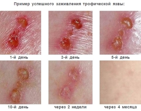 Стелланин маст. Упутства за употребу, ефикасност, прегледи, аналоги