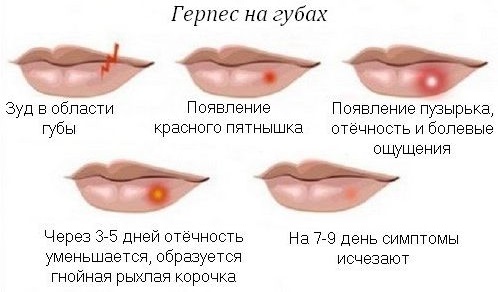 Стелланин маст. Упутства за употребу, ефикасност, прегледи, аналоги