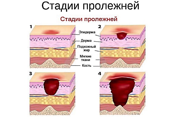 Стелланин маст. Упутства за употребу, ефикасност, прегледи, аналоги
