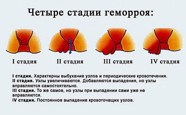 Стелланин маст. Упутства за употребу, ефикасност, прегледи, аналоги