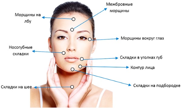 Căng da mặt bằng lưới 3D cho khuôn mặt, môi, trán, bụng. Trước và sau hình ảnh, đánh giá, giá của thủ tục