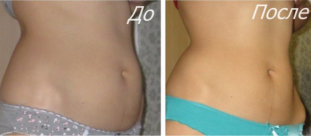 Máy hút bụng.Cách tập đúng bài, kỹ thuật giảm cân, bơm căng, hóp bụng sau sinh