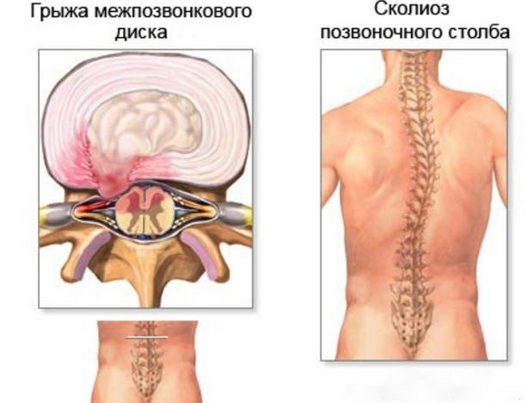 Máy hút bụng. Cách tập đúng bài, kỹ thuật giảm cân, bơm căng, hóp bụng sau sinh