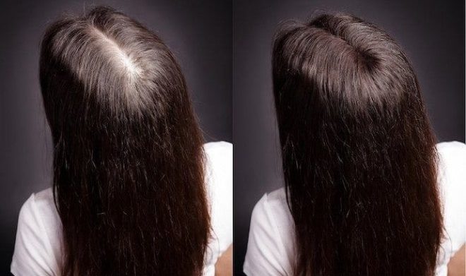 فيتامينات مرز للشعر والأظافر. تعليمات الاستخدام والتكوين والآثار الجانبية والمراجعات