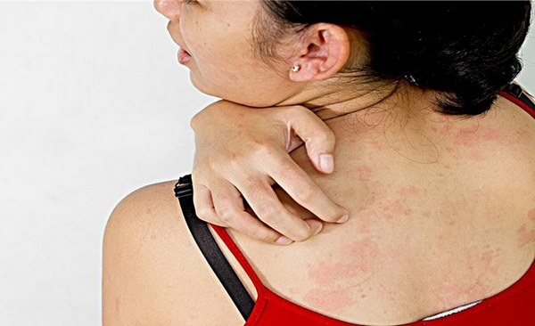 فيتامينات مرز للشعر والأظافر. تعليمات الاستخدام والتكوين والآثار الجانبية والمراجعات