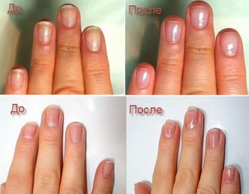 Manicure japonesa: o que é, P-shine, Masura, sets e tecnologia passo a passo com uma foto