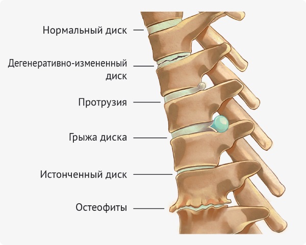 Јога за леђа и кичму: карактеристике, индикације и контраиндикације, сет једноставних вежби, најбоље асане. Видео за почетнике