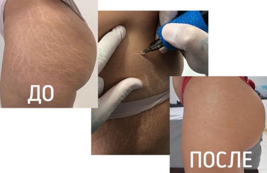 Quy tắc chăm sóc cơ thể cho một phụ nữ ở độ tuổi 20, 30, 40, 50 tuổi. Làm thế nào để cơ thể đẹp, cân đối và thon gọn ở mọi lứa tuổi