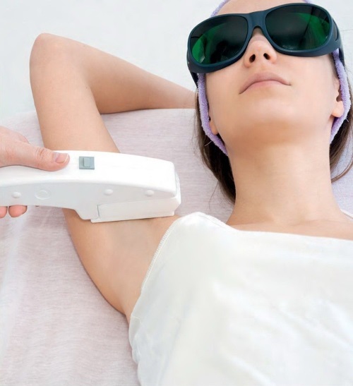 AFT triệt lông - triệt lông bằng laser trên mặt và cơ thể, vùng bikini tại thẩm mỹ viện và tại nhà. Thiết bị, đánh giá và giá cả