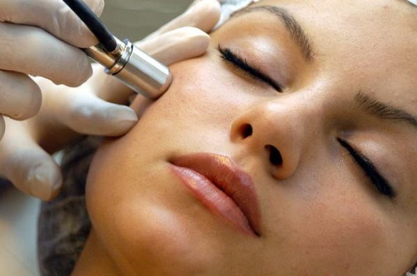 Microdermoabrasão de diamante do rosto - o que é, aparelhos, cremes para micropeeling enzimático. Preço do procedimento