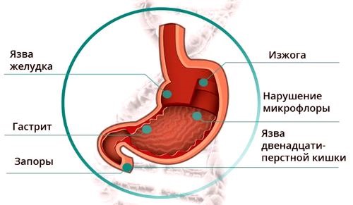Лудо сушење. Задаци за сваки дан, 1, 2 недеље, програм обуке за жене, исхрана, дијета. Рецензије и фотографије