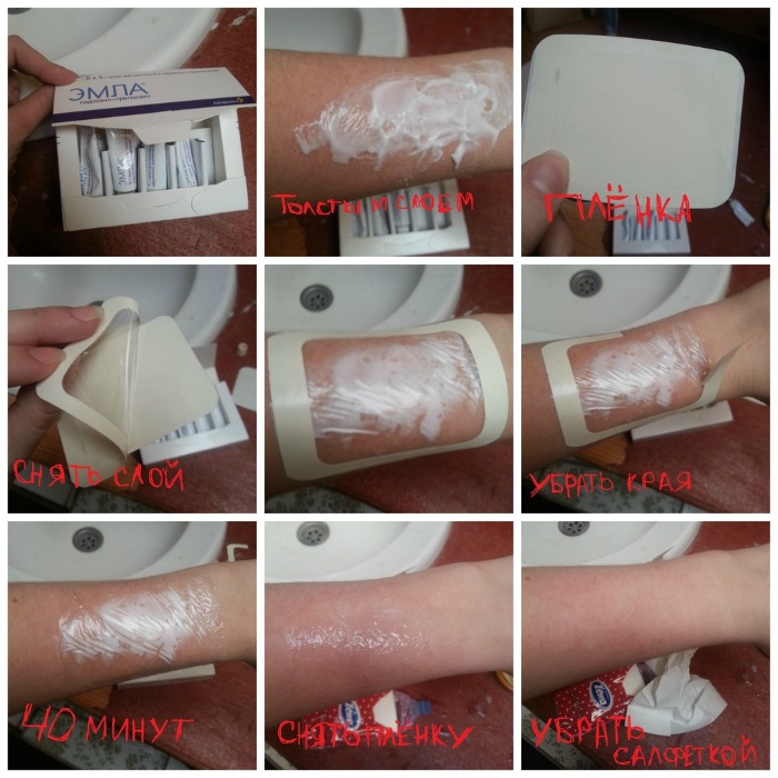 Emla. Hướng dẫn sử dụng, thành phần, cách thoa trước khi nhổ lông vùng bikini. Phương tiện tương đương
