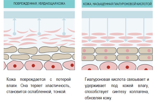 Fonoforesis wajah dengan hidrokortison, caripain, asid hyaluronik. Petunjuk dan kontraindikasi, alat untuk prosedur ultrasound