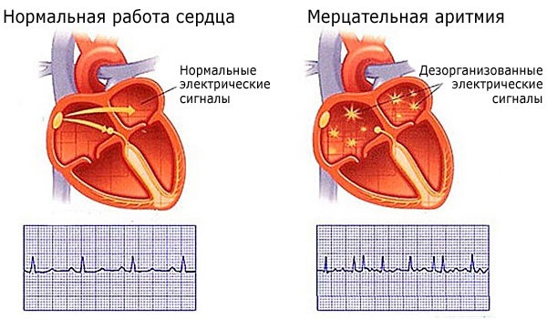 Глутатион - шта је то, користи за тело. Упутства за употребу у козметологији, прегледи лекара